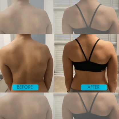 Instant Posture Corrector